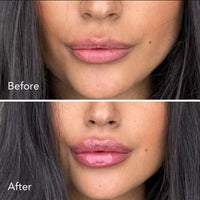 Lip Plumper Moisturizing Essence Pen by Can Mama – Hydrate, Plump & Gloss Lips