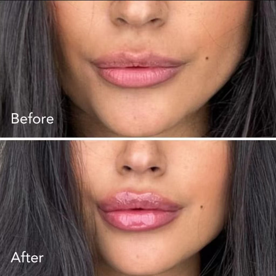 Lip Plumper Moisturizing Essence Pen by Can Mama – Hydrate, Plump & Gloss Lips